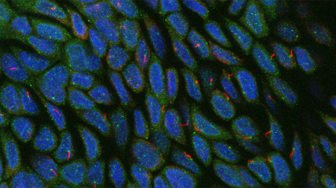 Immunofluorescence of a cell monolayer: nuclei in blue, primary cilia in red